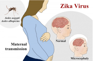 Maternal Transmission of Zika Virus